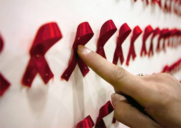 В Москве число заболевших ВИЧ выросло на 20% с прошлой проверки