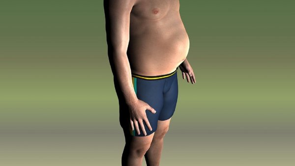 «Одна сосиска – два часа пешком»: Врач дал рекомендации по профилактике ожирения